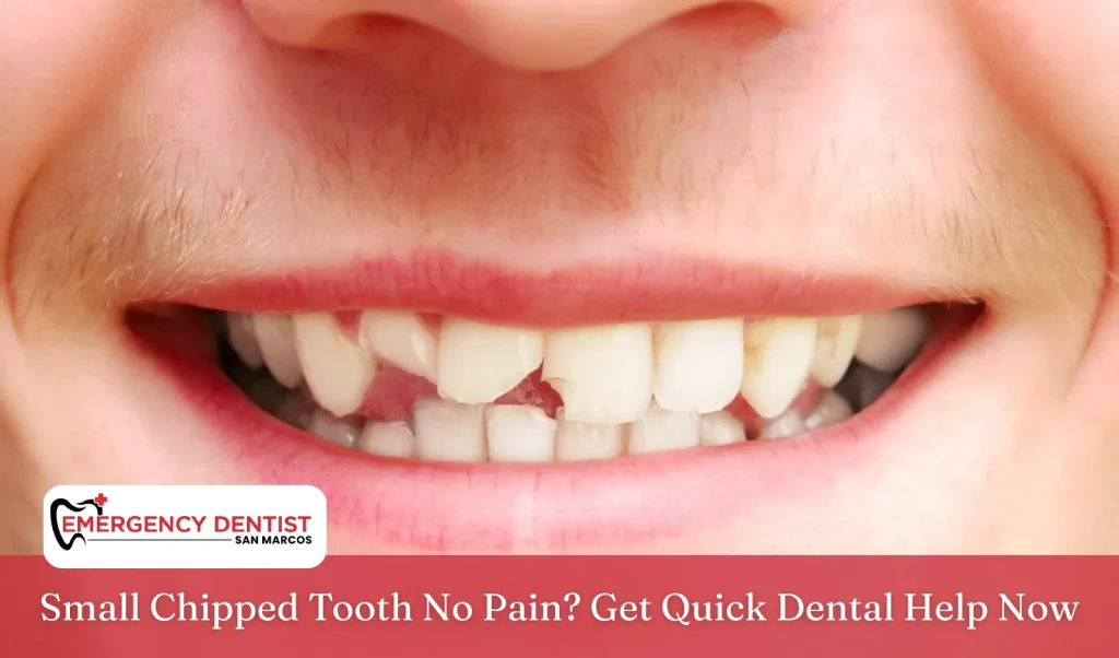 Small Chipped Tooth No Pain Get Quick Dental Help Now