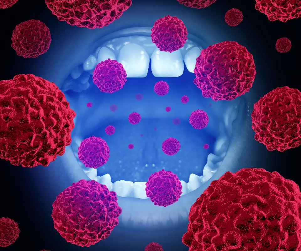 Oral-Cancer-San-Marcos-CA